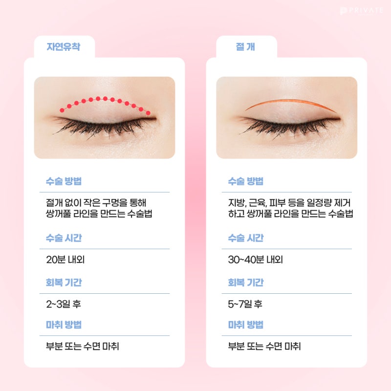 Private Plastic Surgery Clinic, Incisional Double Eyelid Surgery