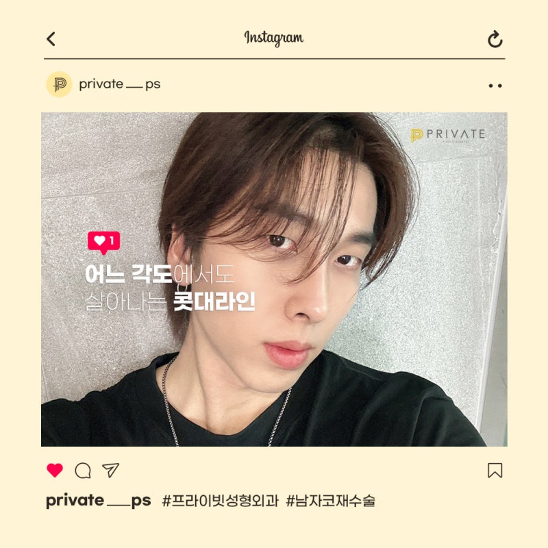 男性鼻部重修手術做得好的地方是新沙站Private整形外科 사진 7