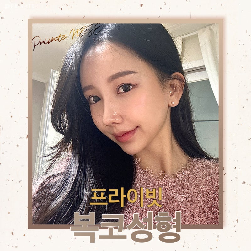 신사복코성형수술로 세련된 라인을 확인해보세요 사진 2