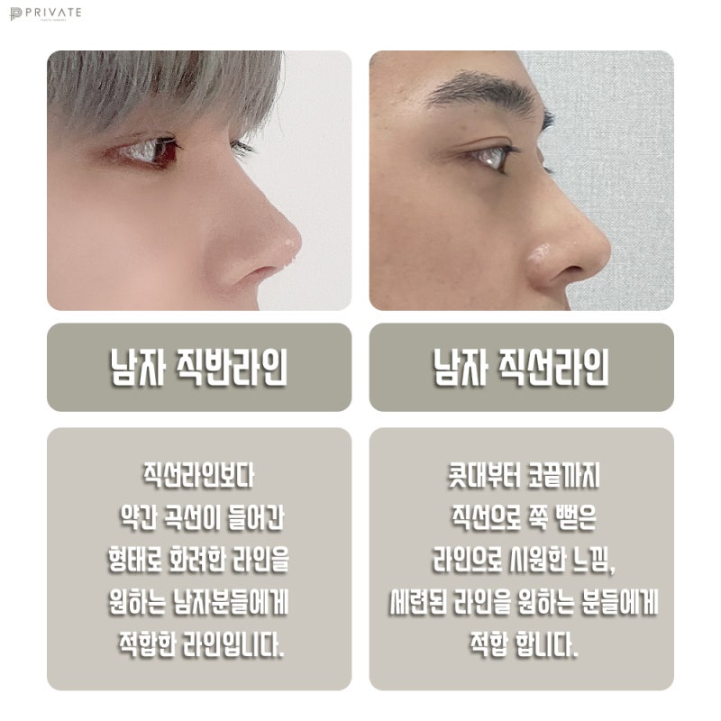 신사남자코성형수술 남자다운라인으로 세련되게 사진 4