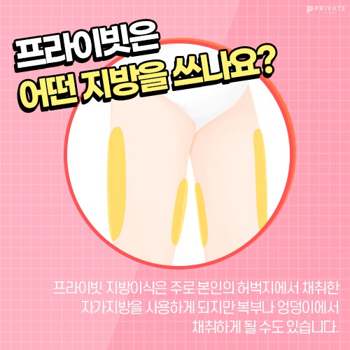 Начните с молодого лица с помощью пересадки жира на все лицо в Private Plastic Surgery 사진 5