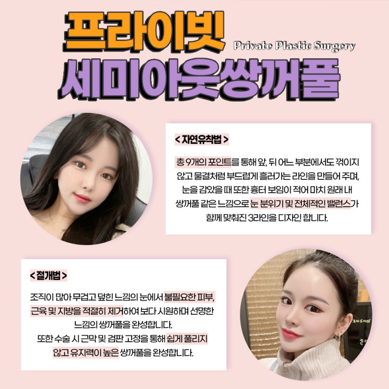 Private Plastic Surgery: Achieving a Natural and Elegant Semi-Outlined Double Eyelid 사진 4
