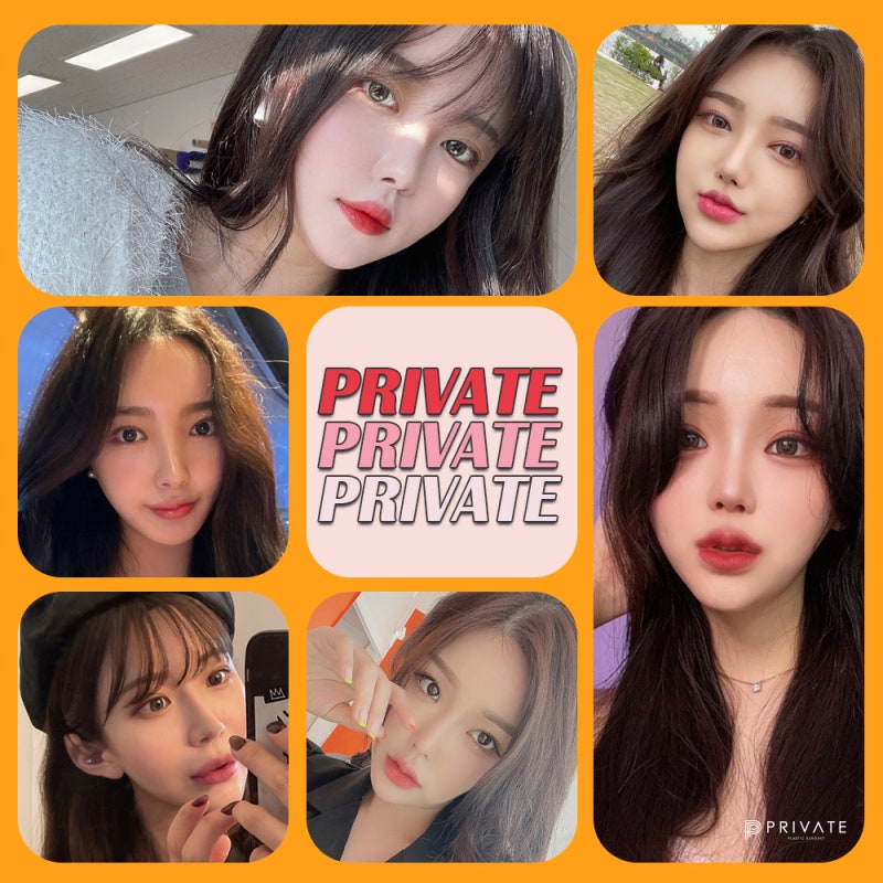 Private Plastic Surgery: Achieving a Natural and Elegant Semi-Outlined Double Eyelid 사진 6