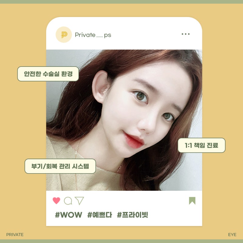 Achieving Proportion with Double Eyelid Revision Surgery at a Reputable Clinic 사진 6