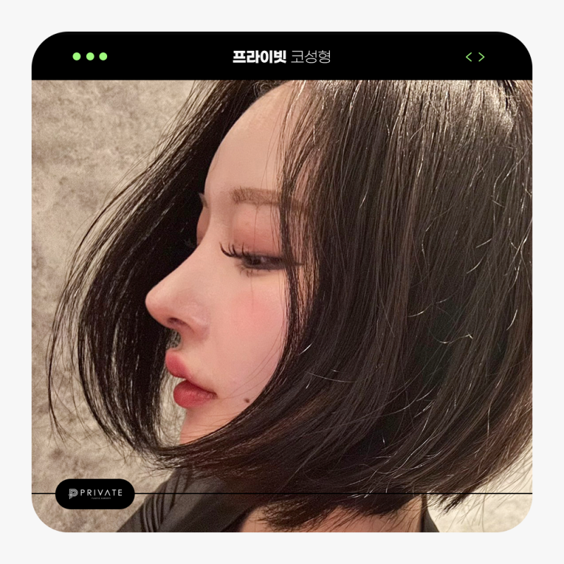 Private Plastic Surgery Clinic: Always Recruiting Plastic Surgery Models and Real Models 사진 7