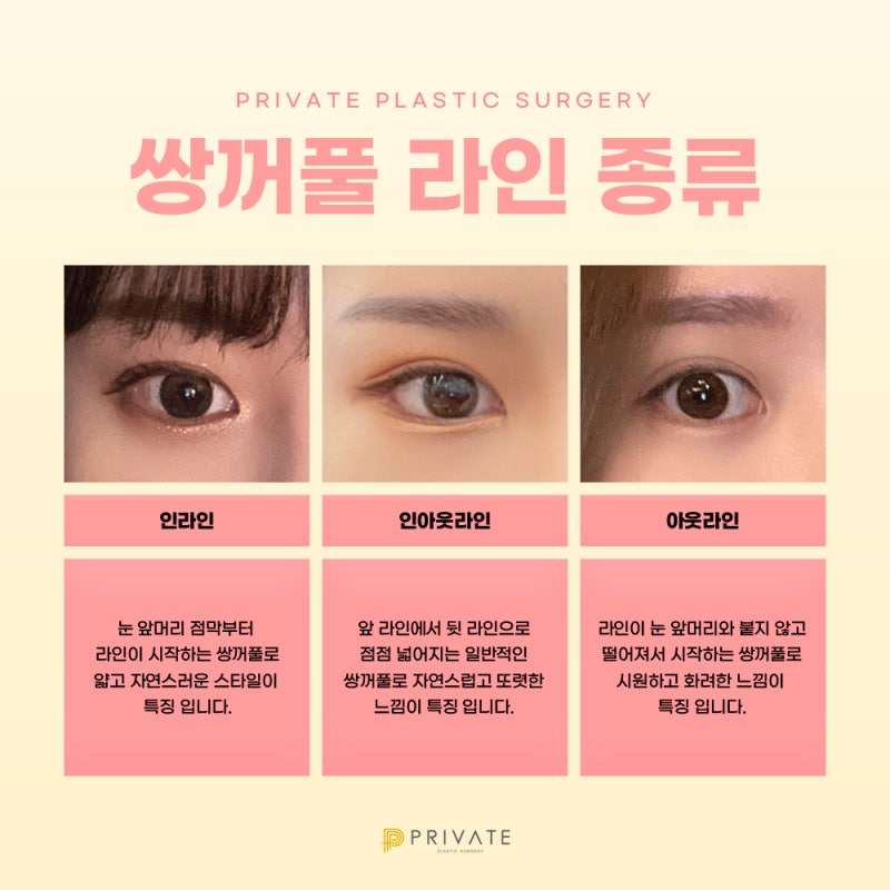 Ulasan Bedah Rekonstruksi Mata di Private Plastic Surgery 사진 5