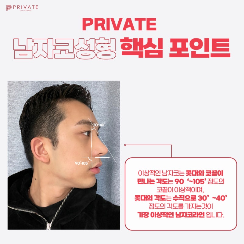 Operasi Hidung Pria dengan Garis Elegan, Private Plastic Surgery 사진 5