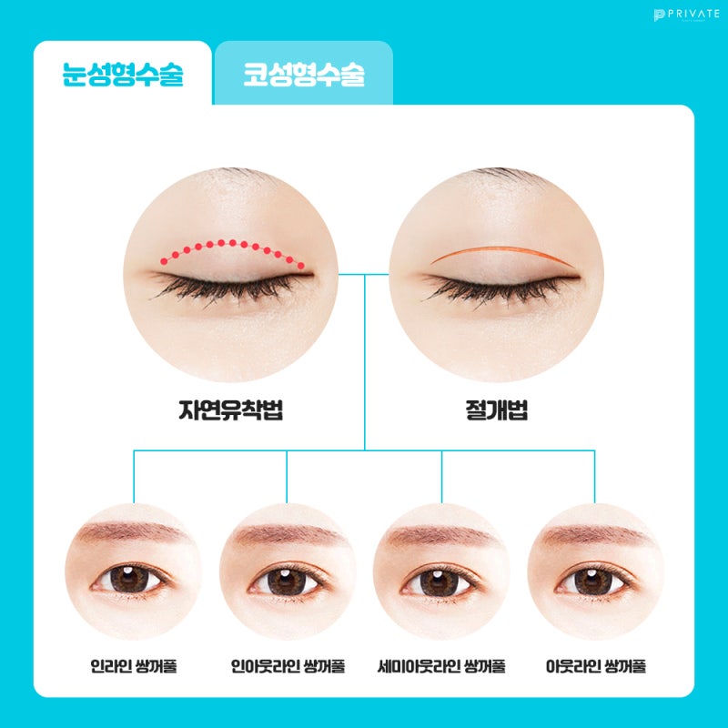 Eye and Nose Surgery Event for Students at Private Plastic Surgery Clinic 사진 3