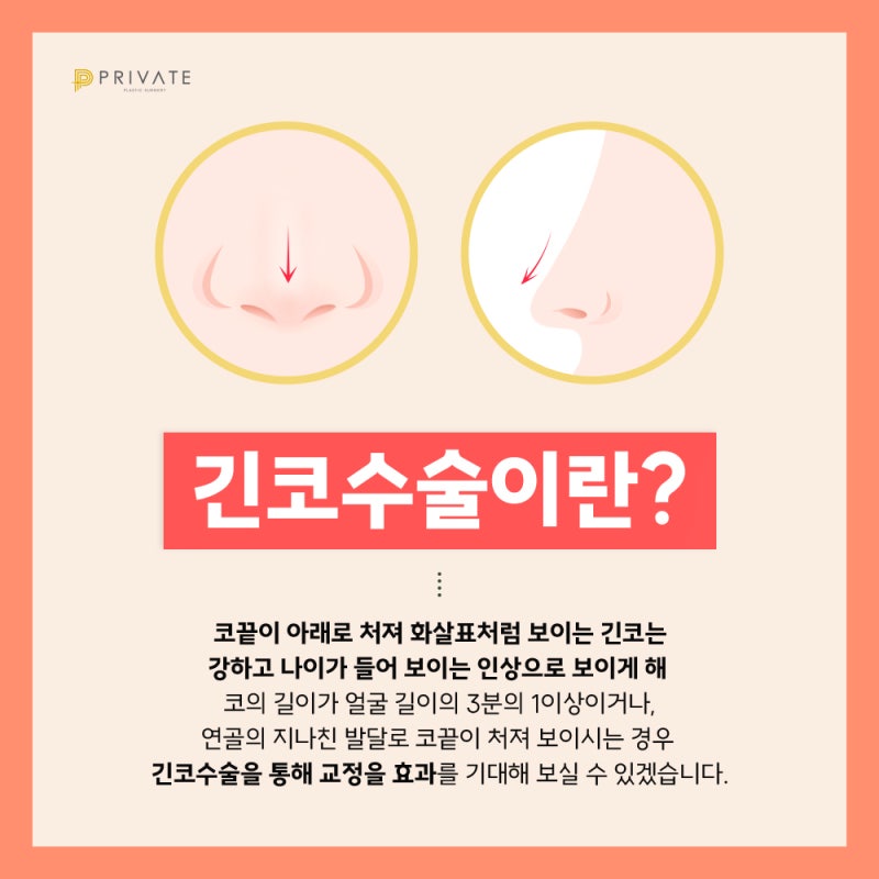 Известная клиника пластической хирургии длинного носа: Private Plastic Surgery 사진 3