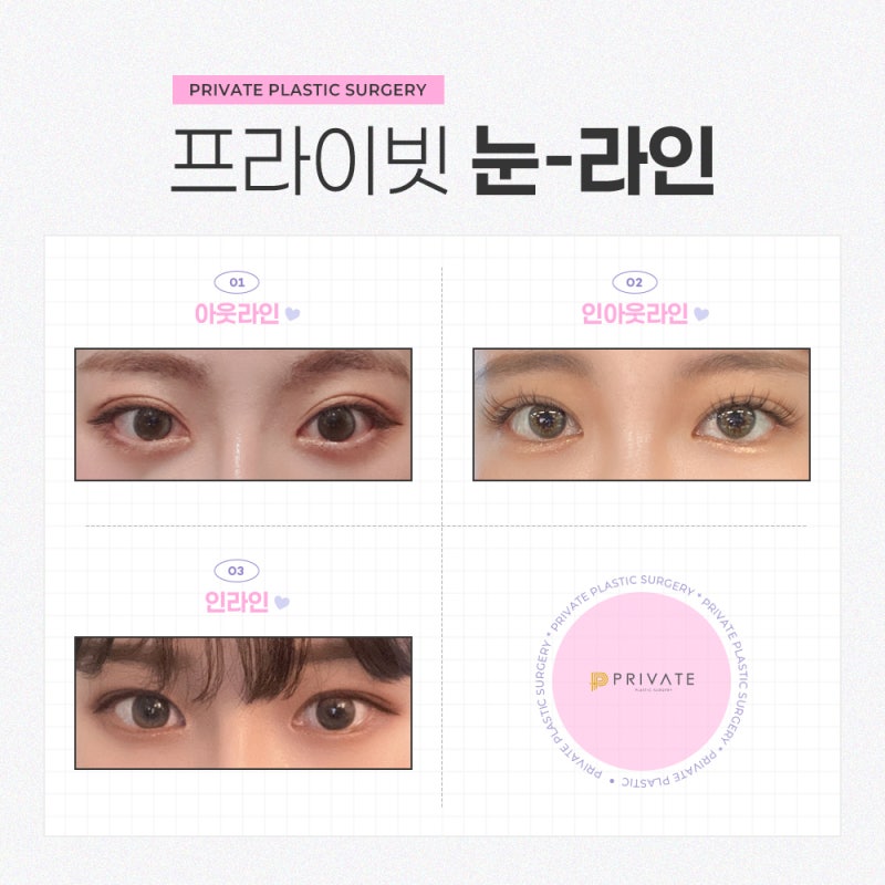 Eye Revision Surgery at Sinsa Private Plastic Surgery Clinic 사진 4