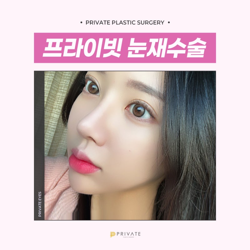 Eye Revision Surgery at Sinsa Private Plastic Surgery Clinic 사진 2