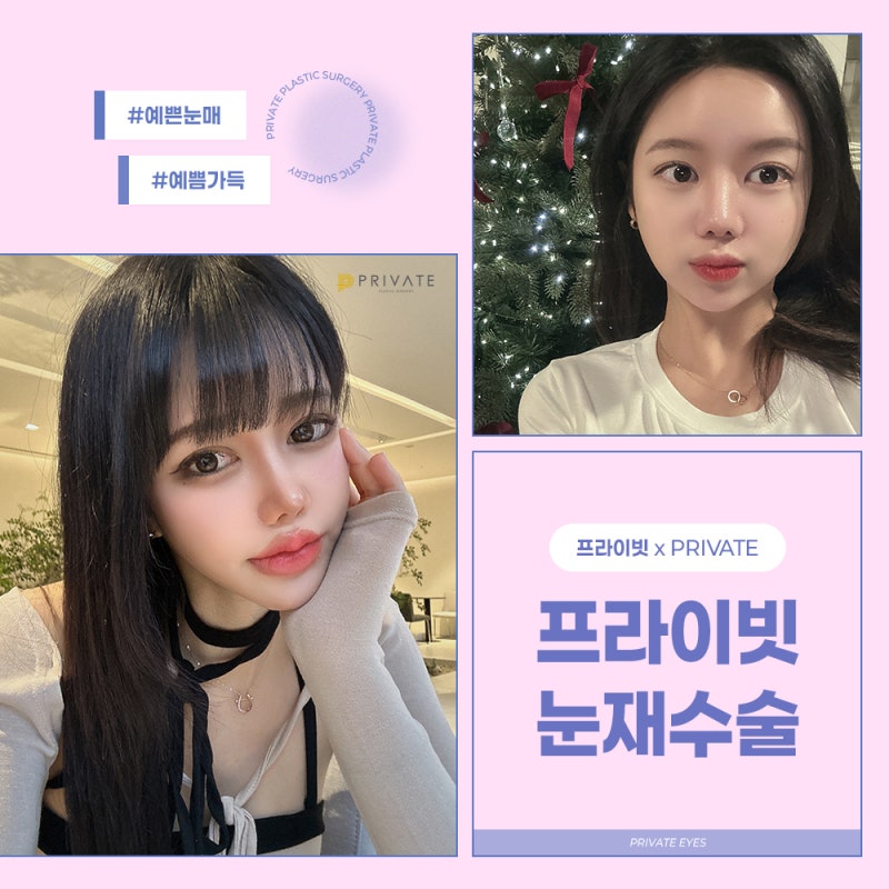 Eye Revision Surgery at Sinsa Private Plastic Surgery Clinic 사진 6