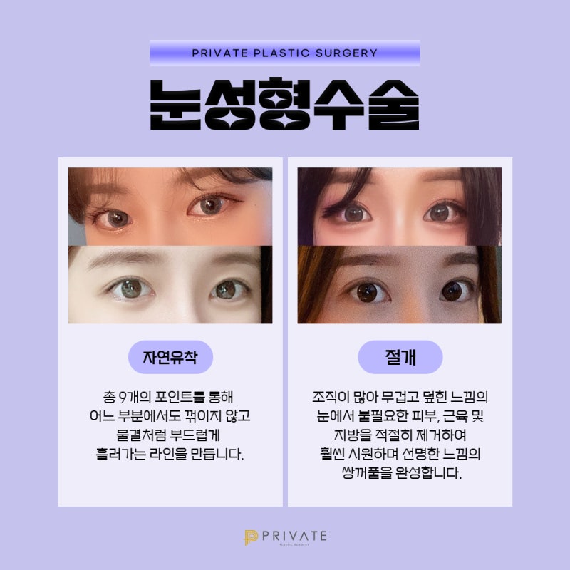 First Eye Plastic Surgery: A Trustworthy Place, Private Plastic Surgery Clinic 사진 4