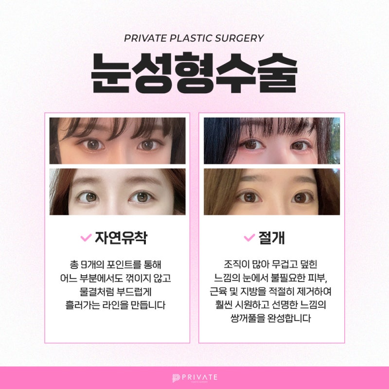 Private Plastic Surgery Clinic: Where to Get Beautiful Double Eyelid Surgery 사진 4