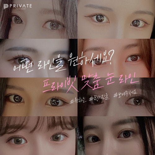 Private Plastic Surgery Clinic: Where to Get Beautiful Double Eyelid Surgery 사진 6