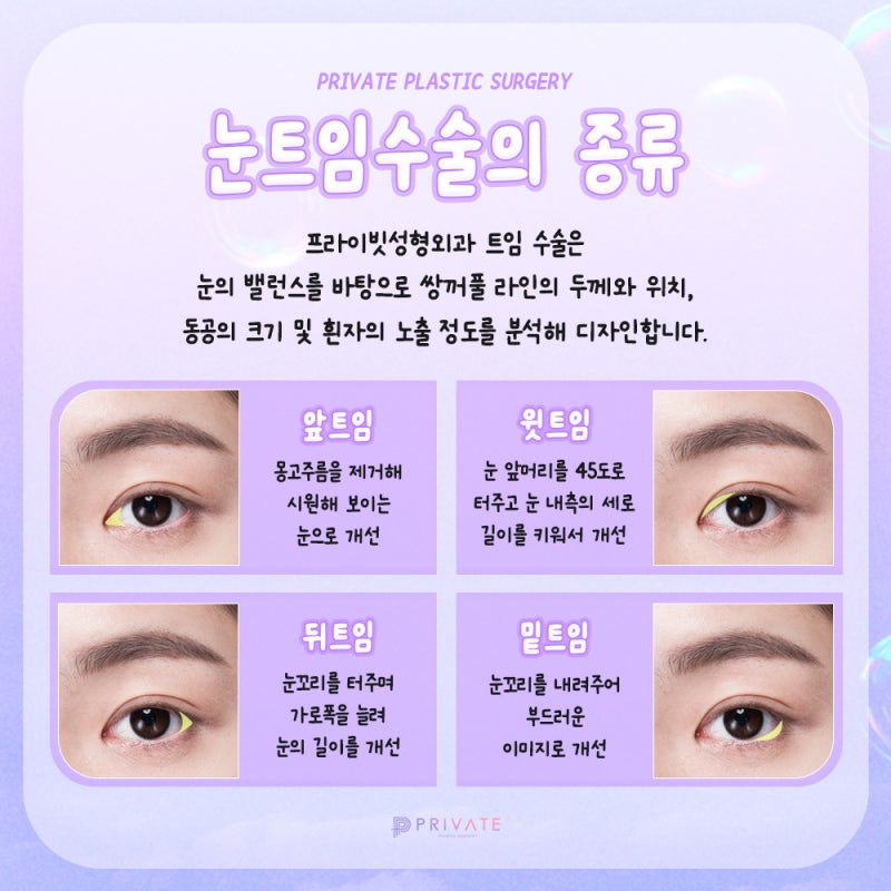 Operasi Pembukaan Mata yang Rapi dan Bagus di Private Plastic Surgery