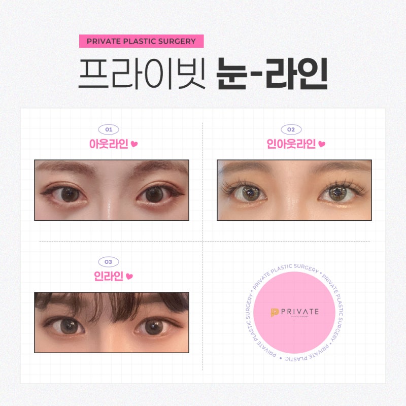 Private Plastic Surgery Clinic: Renowned for Eye Revision Surgery 사진 4