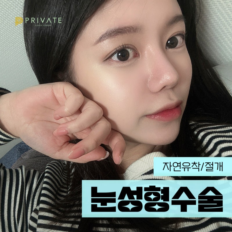 Operasi Mata di Tempat Terpercaya, Private Plastic Surgery 사진 2