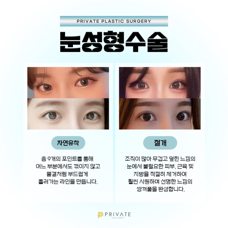 Operasi Mata di Tempat Terpercaya, Private Plastic Surgery