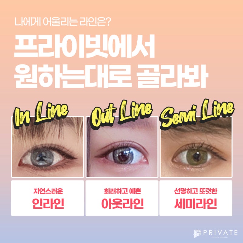 Sinsa Private Plastic Surgery: The Best Place for Eye Reoperation