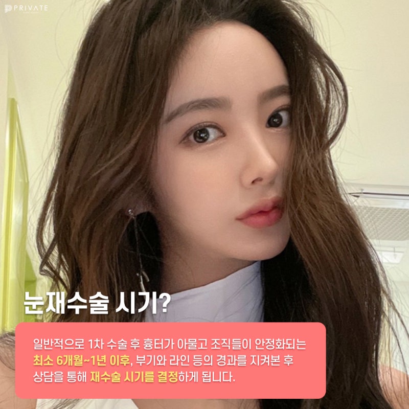 Sinsa Private Plastic Surgery: The Best Place for Eye Reoperation 사진 4