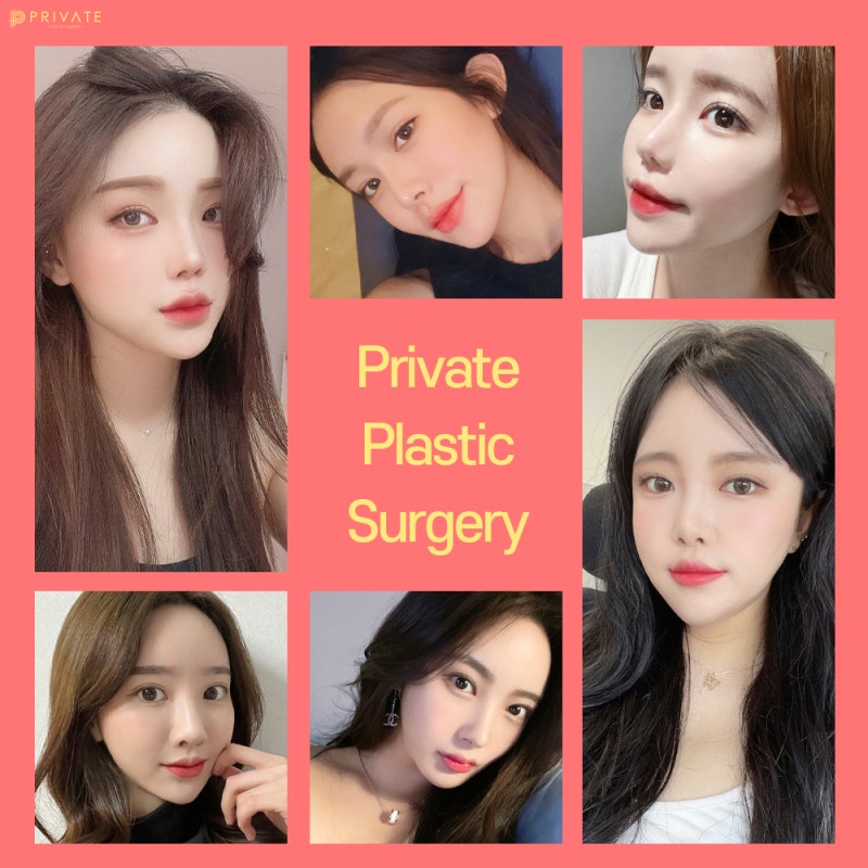 Sinsa Private Plastic Surgery: The Best Place for Eye Reoperation 사진 7