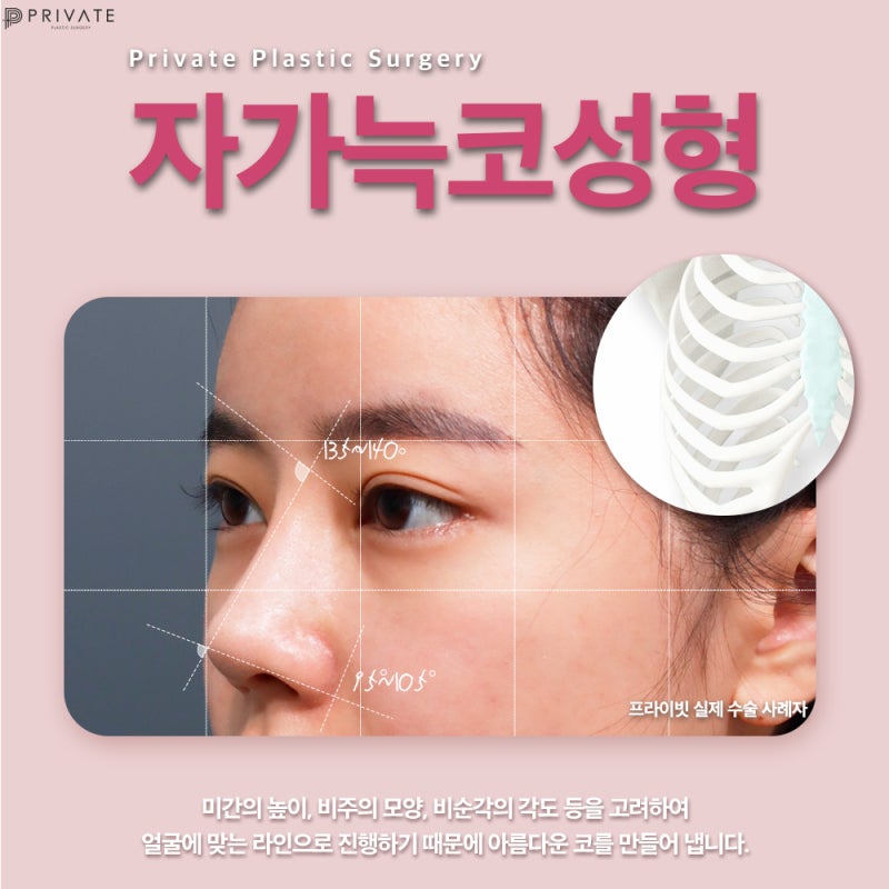 Nếu bạn đang cân nhắc phẫu thuật nâng mũi bằng sụn sườn tự thân, hãy đến Bệnh viện Thẩm mỹ Private