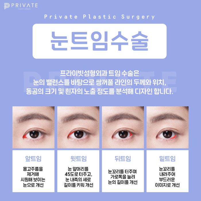 Sinsa Private Plastic Surgery: The Best Place for Canthoplasty