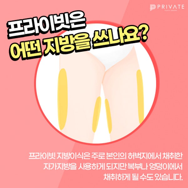 얼굴지방이식잘하는곳은 신사역 프라이빗성형외과
