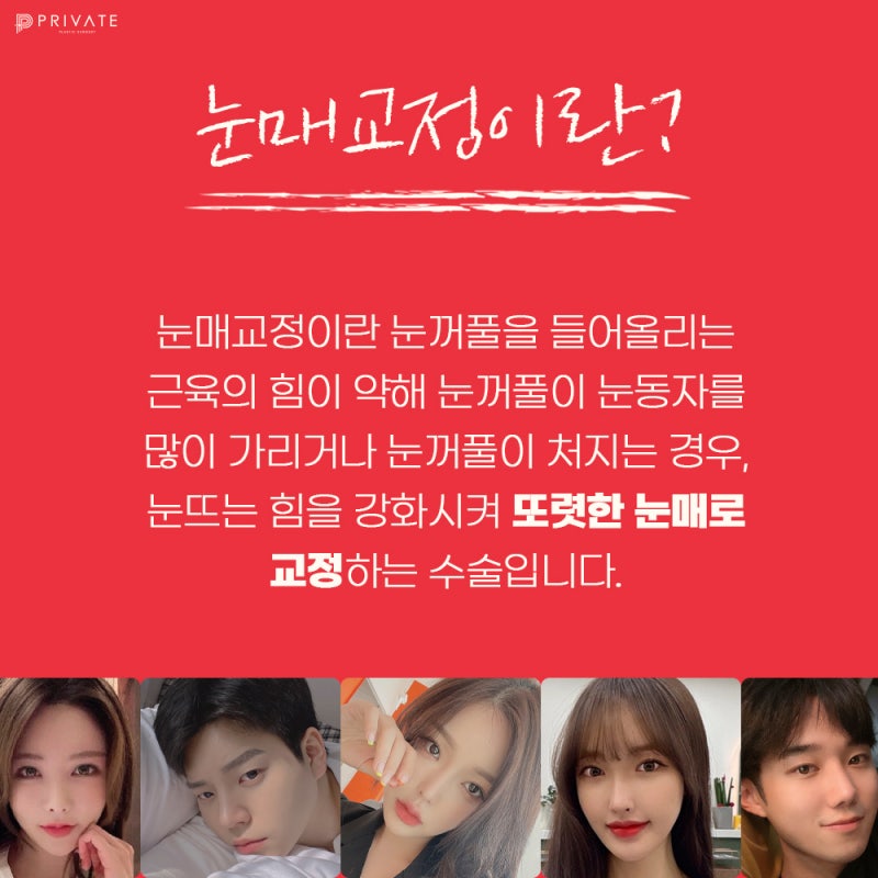눈매교정수술전후 보정없는 프라이빗성형외과
