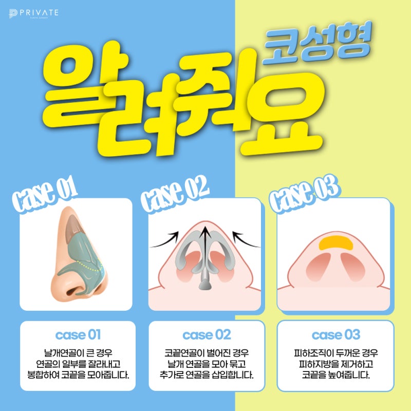 Ulasan Operasi Hidung Babi di Private Plastic Surgery 사진 4