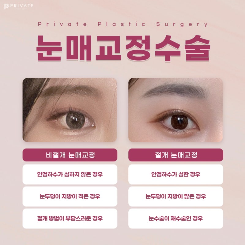 Private Plastic Surgery Clinic: The Best Place for Ptosis Correction and Double Eyelid Surgery 사진 6
