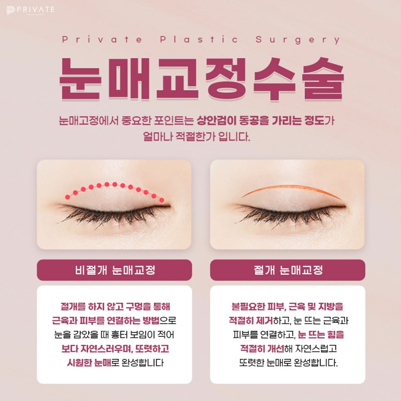 Private Plastic Surgery Clinic: The Best Place for Ptosis Correction and Double Eyelid Surgery 사진 5