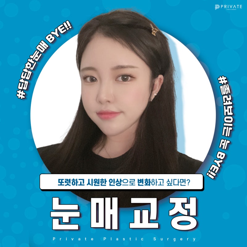 프라이빗성형외과 눈매교정수술후기 비교가 딱이야 사진 2