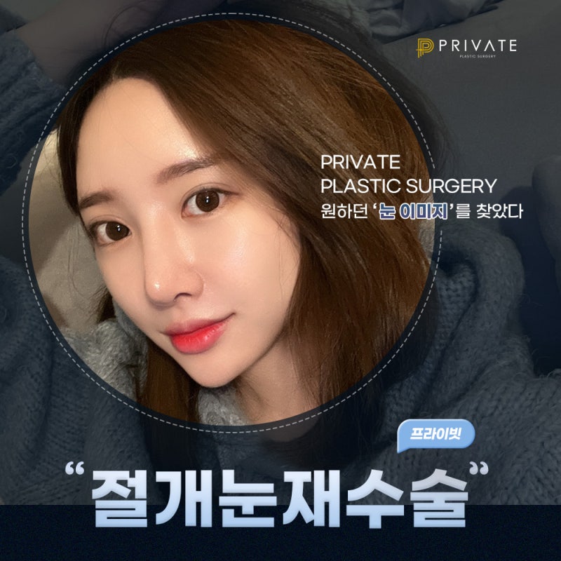 Sinsa Eye Revision Surgery: Discover Private Plastic Surgery Clinic 사진 2