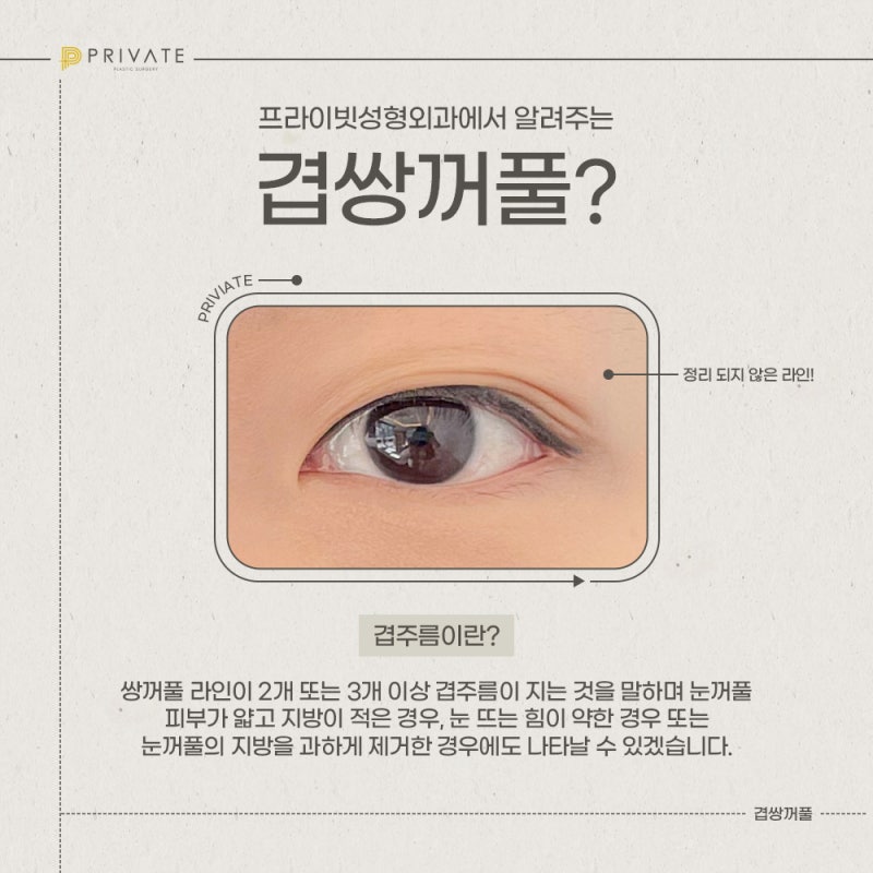 Double Eyelid Revision Surgery at Private Plastic Surgery Clinic