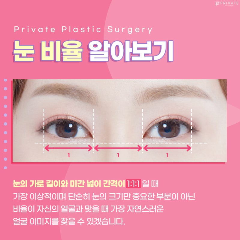 Full Epicanthoplasty at Private Plastic Surgery Clinic 사진 4