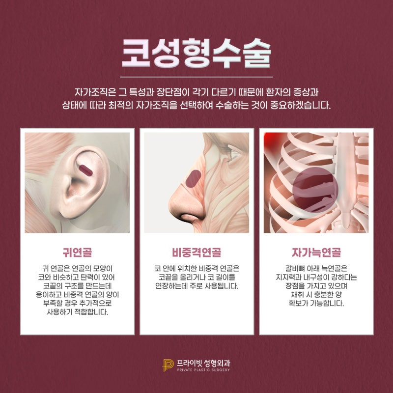 Thẩm mỹ viện tư nhân Sinsa, nơi có đánh giá tốt về nâng mũi thấp 사진 4