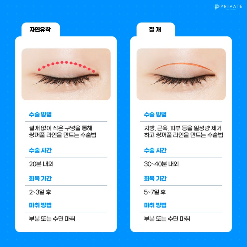 Learn About Incisional Double Eyelid Surgery at Private Plastic Surgery Clinic