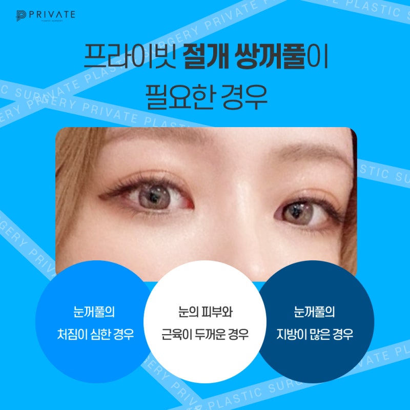 Learn About Incisional Double Eyelid Surgery at Private Plastic Surgery Clinic 사진 5