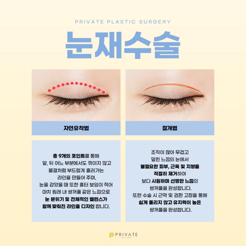 Private Plastic Surgery Clinic ที่มีรีวิวการผ่าตัดแก้ไขตาสองชั้นที่ดี 사진 4