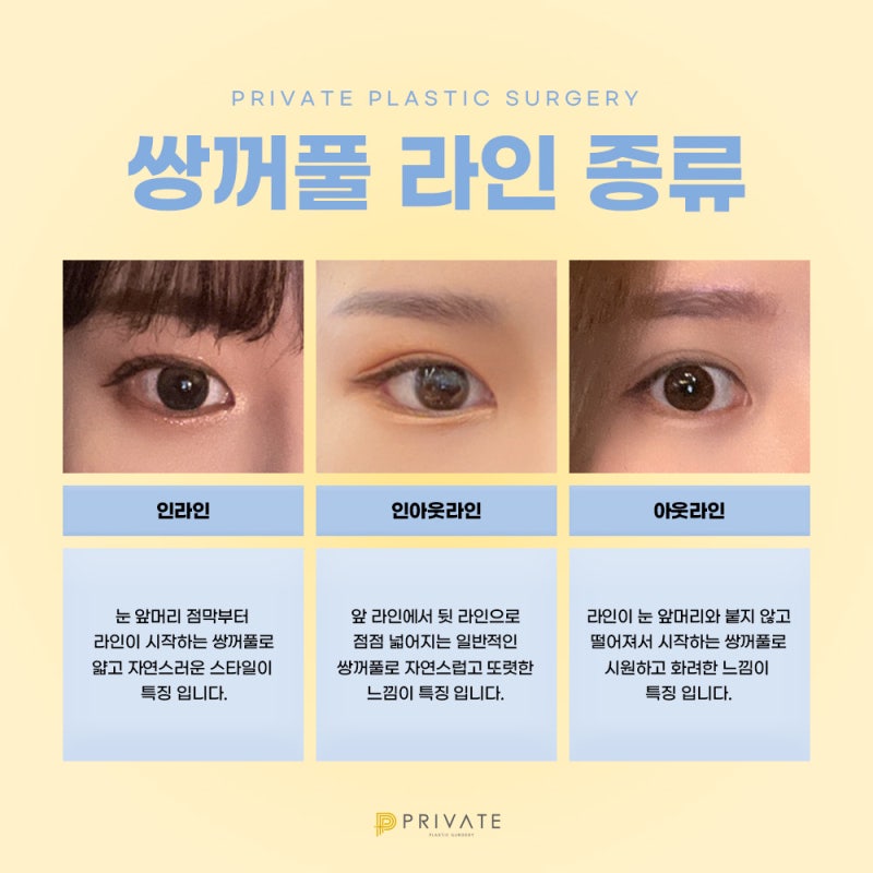 Private Plastic Surgery Clinic ที่มีรีวิวการผ่าตัดแก้ไขตาสองชั้นที่ดี 사진 5