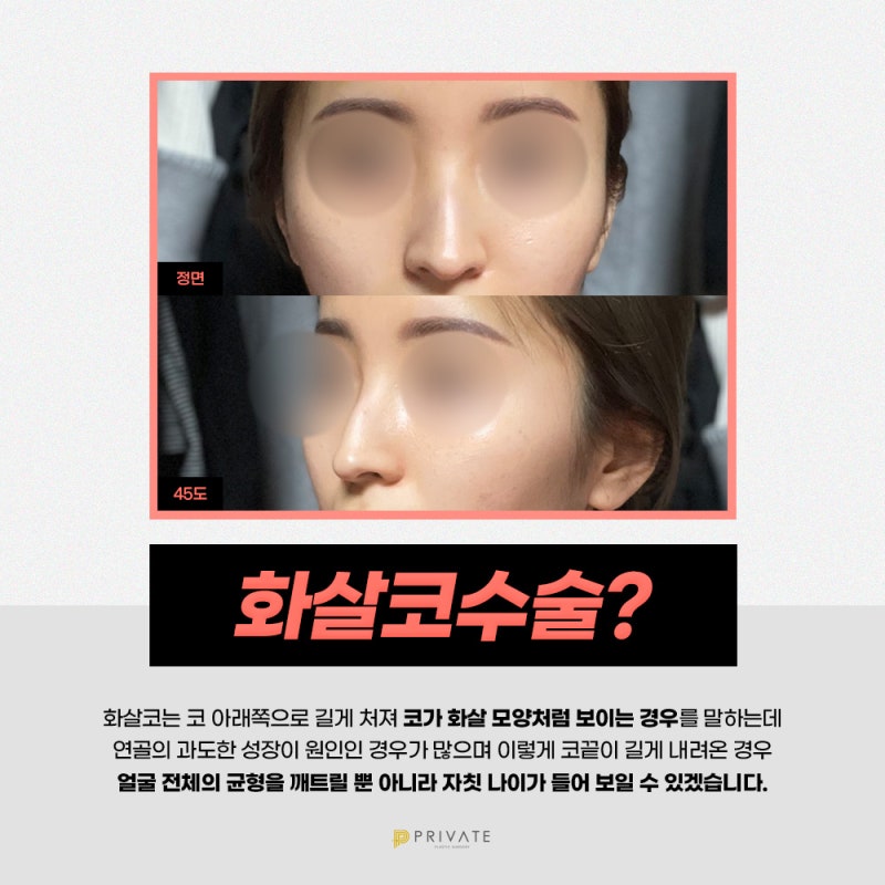 箭鼻整形好评如潮的Private整形外科