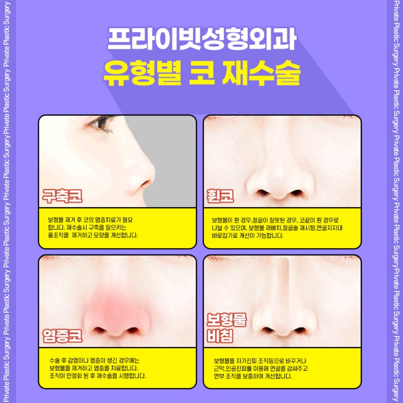 Sinsa Private Plastic Surgery Clinic for Nose Revision Surgery 사진 4