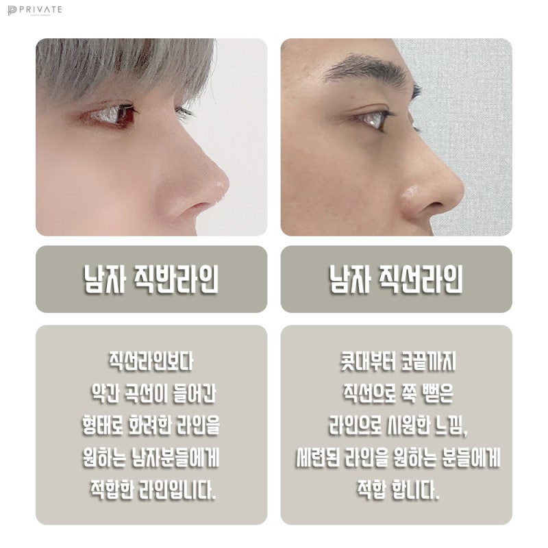 남자코성형전후 후기가 좋은 프라이빗성형외과 사진 4
