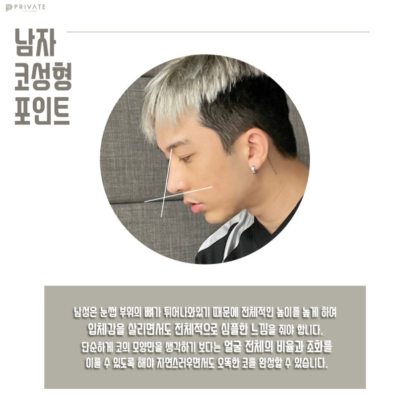 남자코성형전후 후기가 좋은 프라이빗성형외과