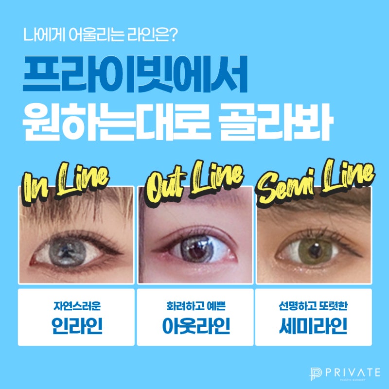 Sinsa Private Plastic Surgery: Excellent Before-and-After Double Eyelid Surgery Results 사진 5
