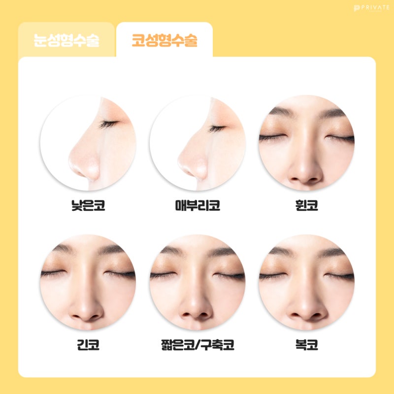 CSAT Event, Private Plastic Surgery Clinic 사진 5