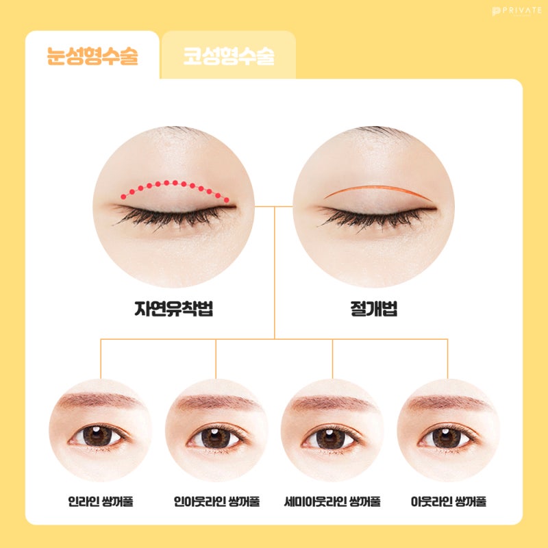 CSAT Event, Private Plastic Surgery Clinic 사진 4