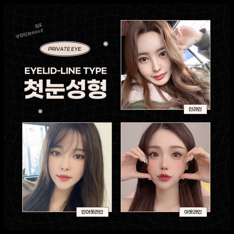 First Eye Surgery at Sinsa Station Private Plastic Surgery Clinic 사진 5